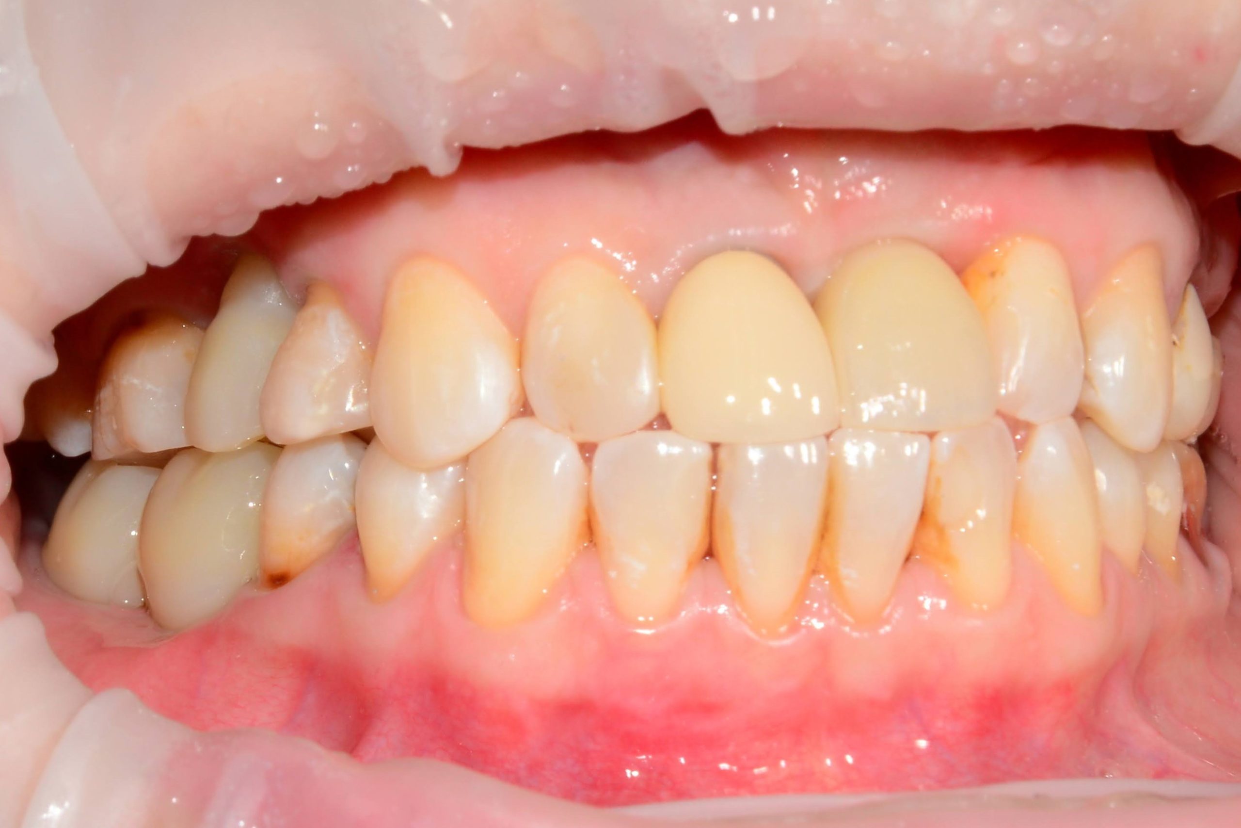 Before