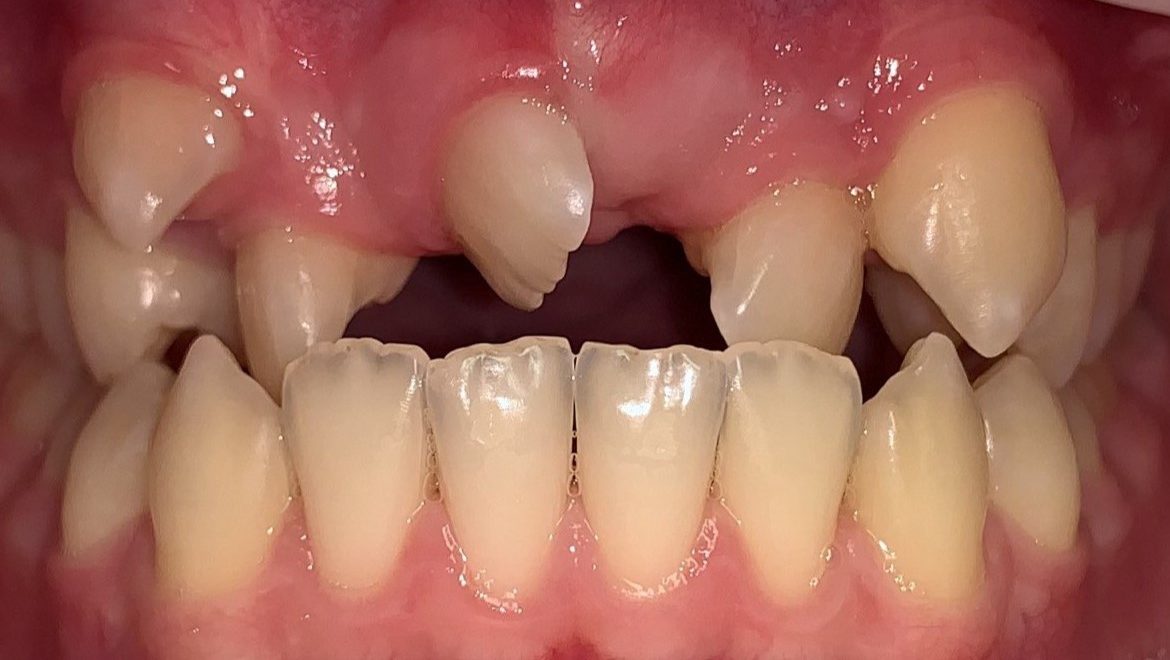 After